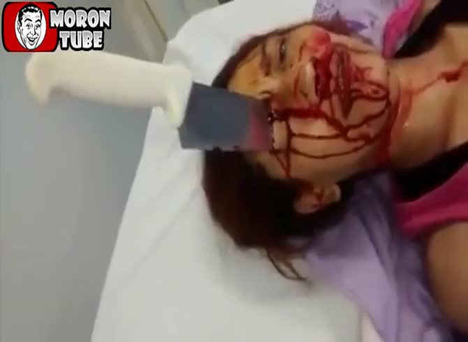 Video :A knife lodged in the eye (public advertisement)